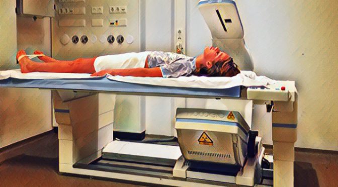 Dexa Scan bij de genderpoli
